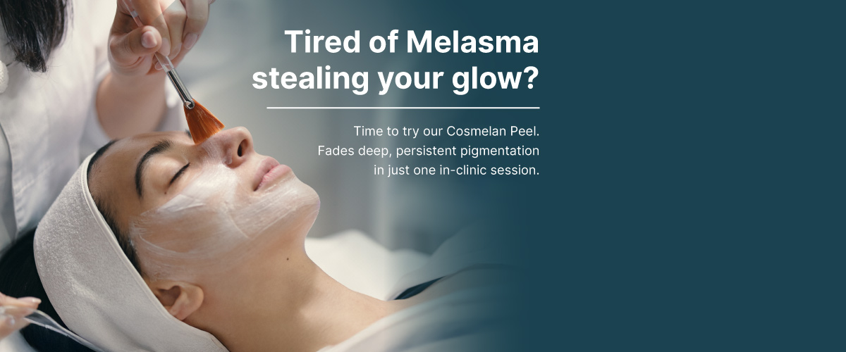 cosmelan peel treatment