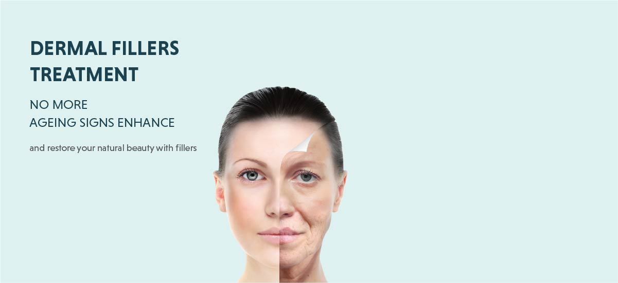 dermal fillers treatment