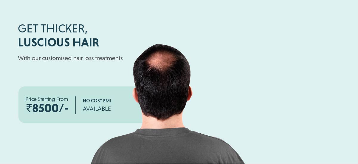 hair loss treatment