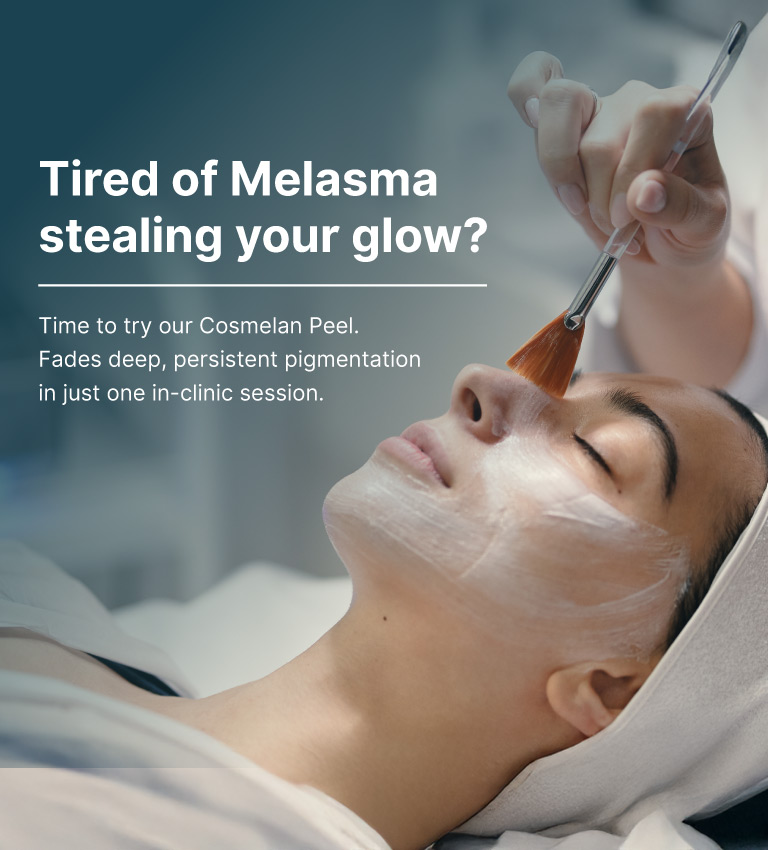 cosmelan peel treatment
