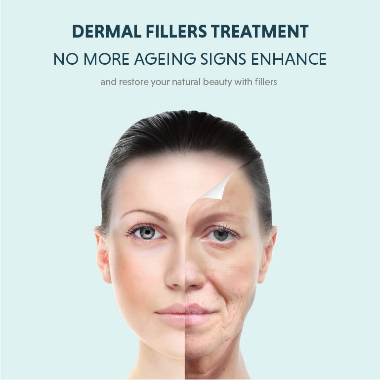 dermal fillers treatment