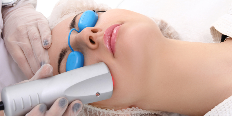 derma roller for acne scars