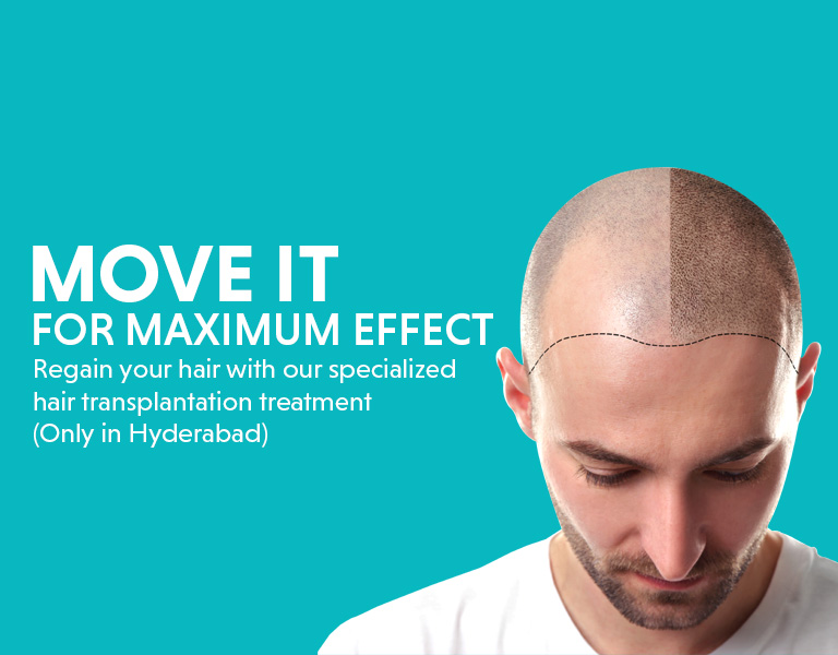 hair transplantation