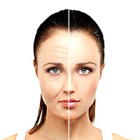 anti aging treatment