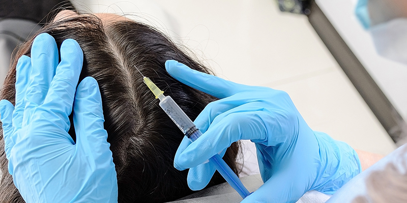 prp hair loss treatment in pune