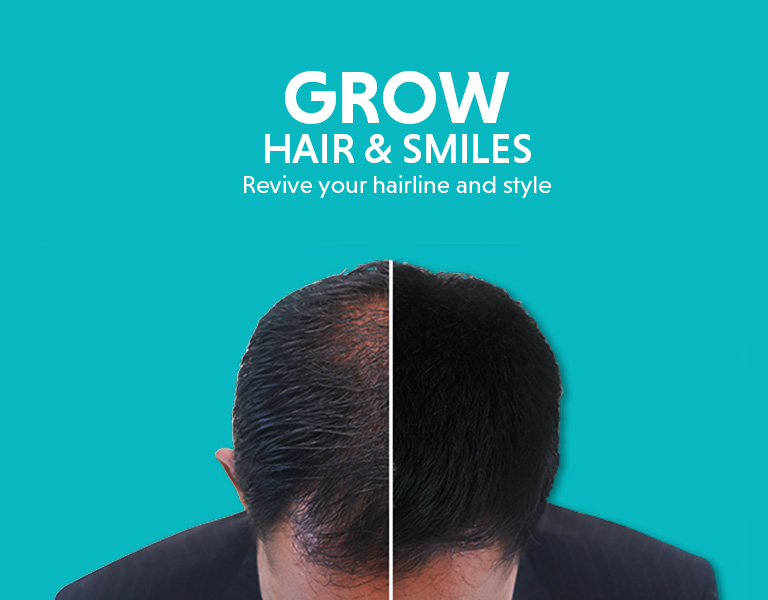 hair-loss-mobile-1