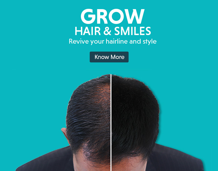 hair-loss-mobile