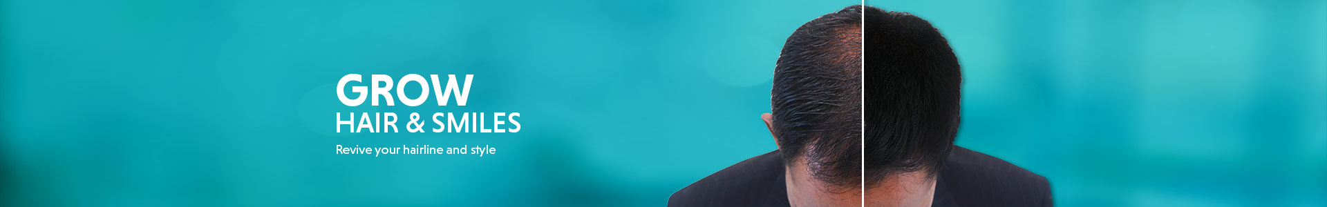 hair-loss-website-1