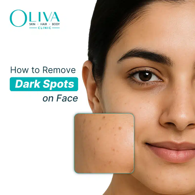 Black Dark Spots On Face