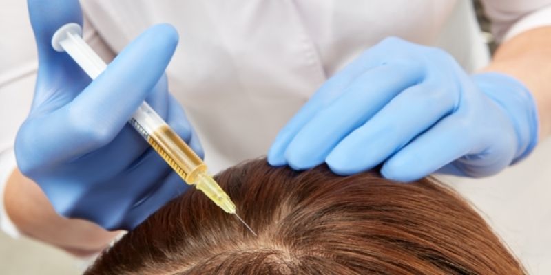 prp hair loss treatment