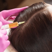 PRP Hair Treatment