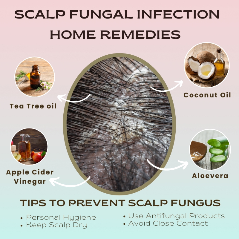 Scalp-Fungus