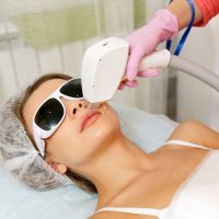 Does Laser Hair Removal Cause Cancer