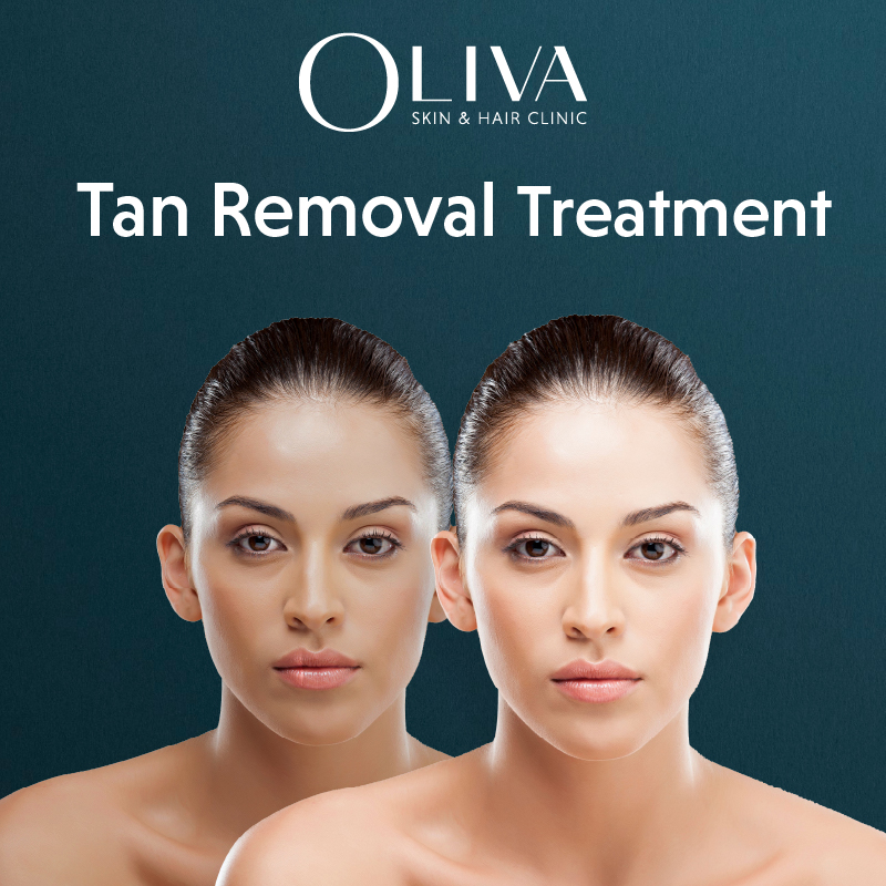 Tan Removal Treatment: Cost, Procedure, Results & Prevention Tips