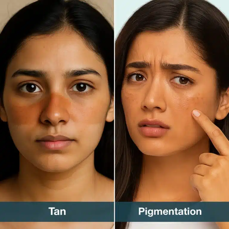 difference between tan and pigmentation