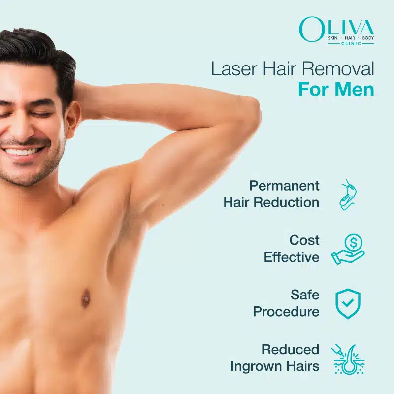 laser hair removal for men