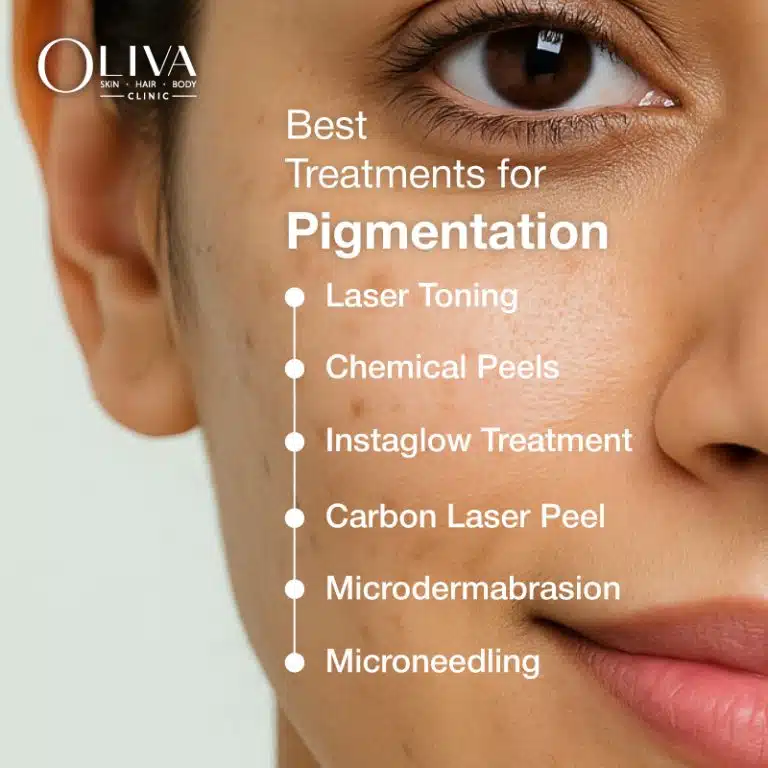 best pigmentation treatments