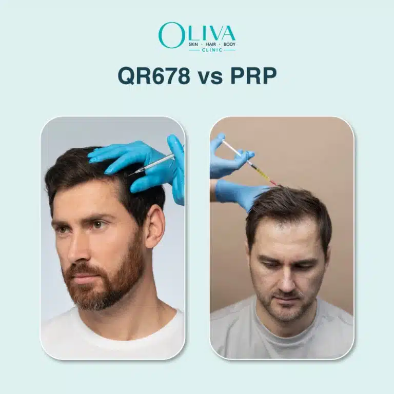 QR678-vs-PRP