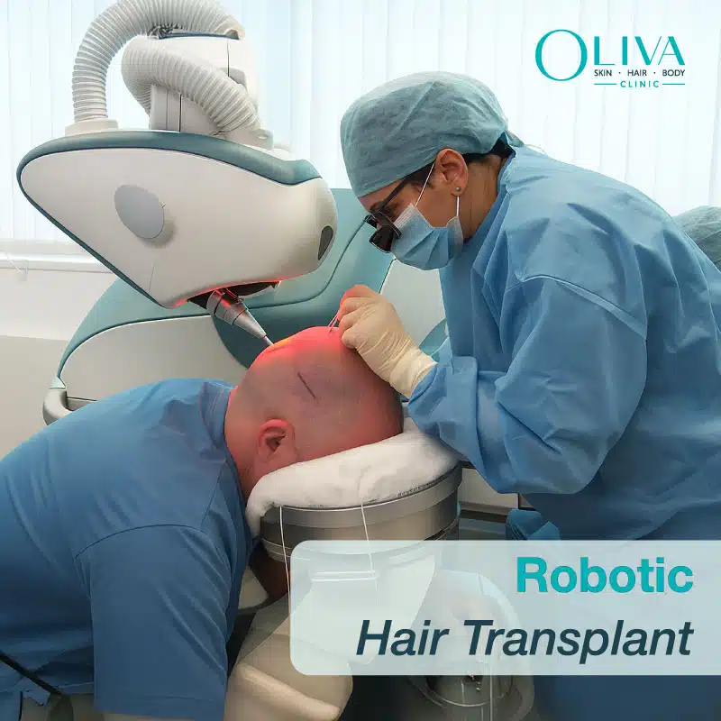 robotic hair transplant