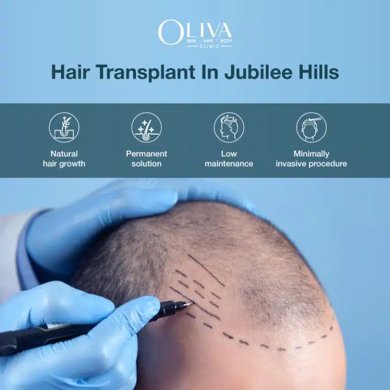 hair transplant in jubilee hills