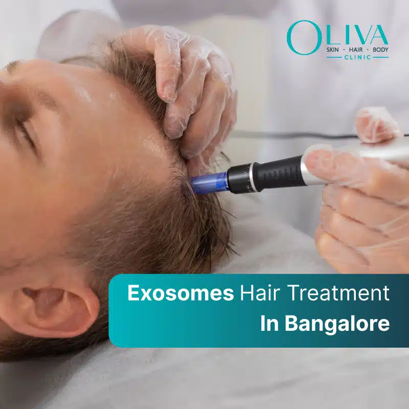 exosomes hair treatment in bangalore